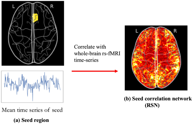 Figure 1: