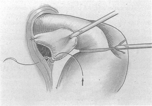 Figure 11.