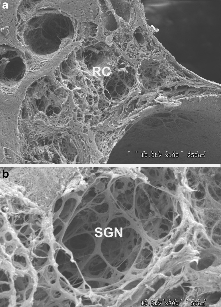 FIG. 16