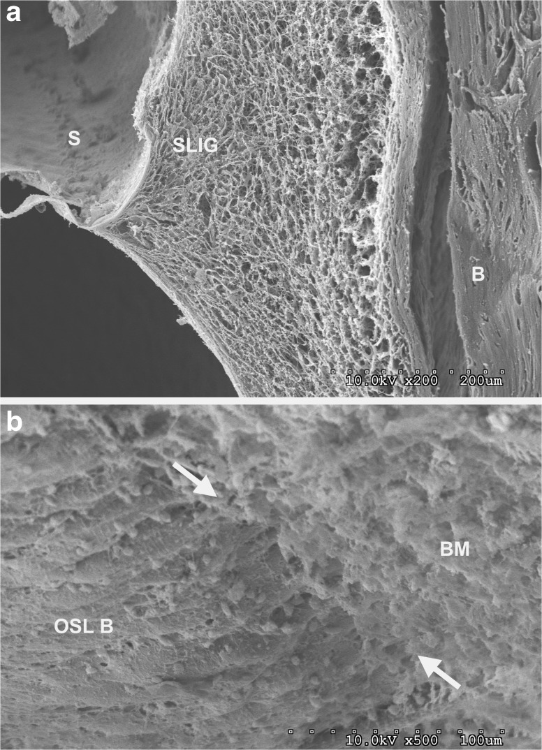 FIG. 15