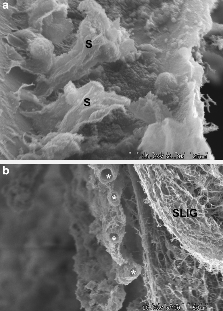 FIG. 13