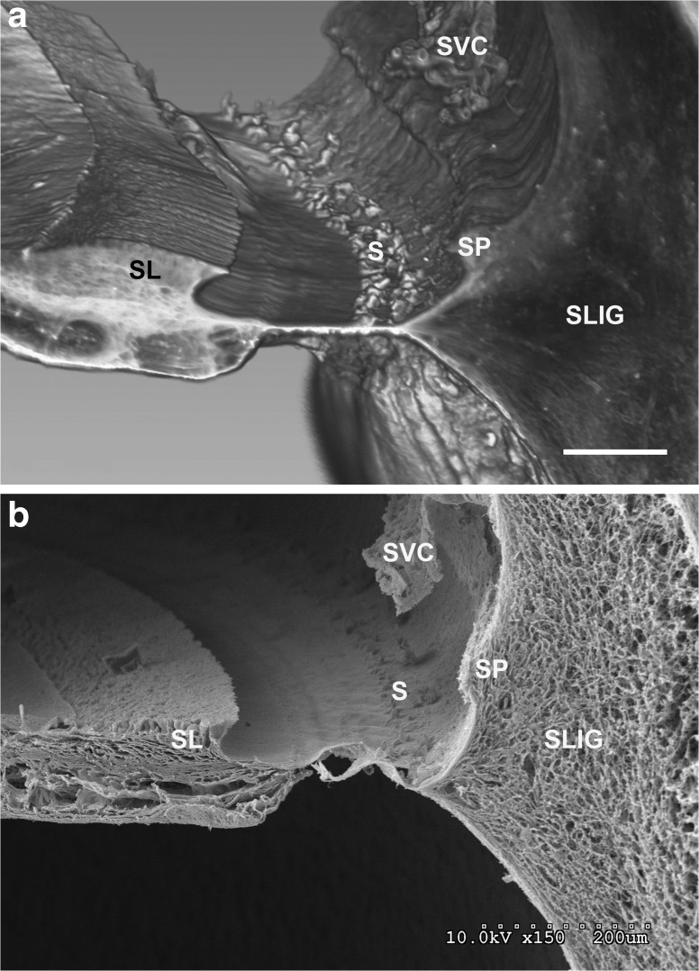 FIG. 11