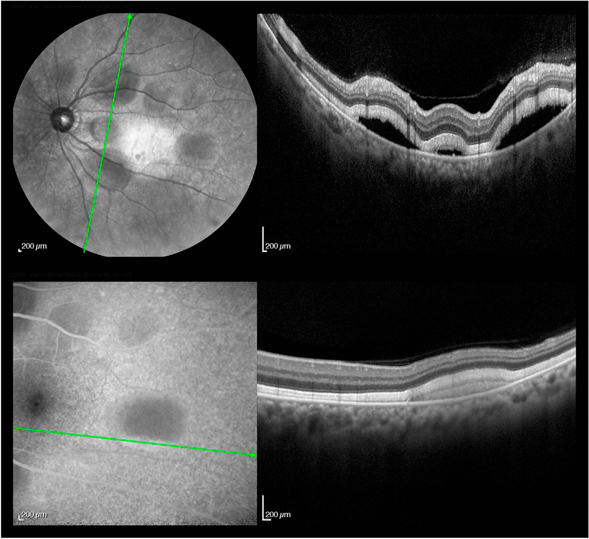 Fig. 4