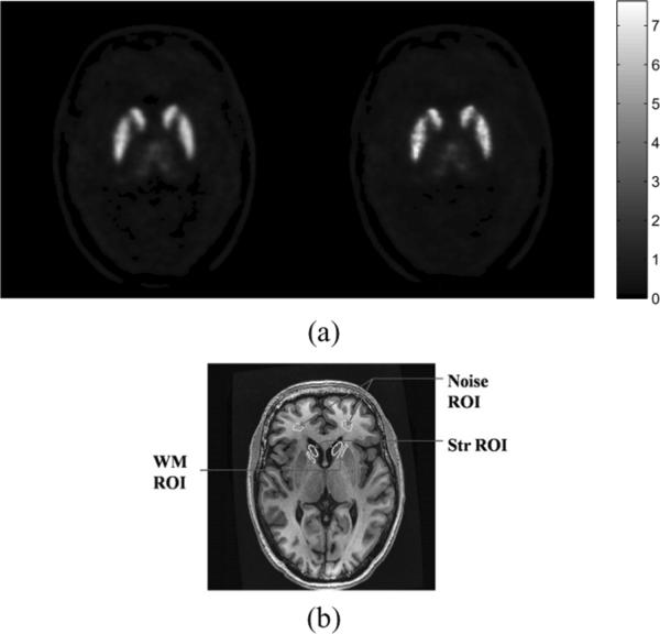 Fig. 13