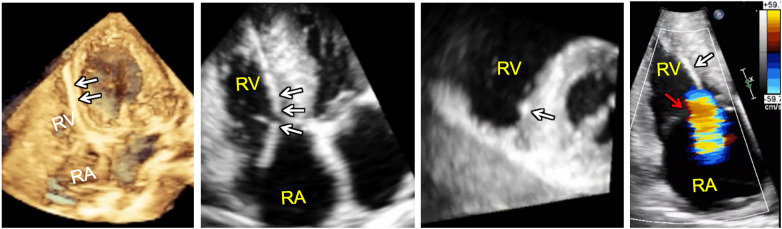 Figure 9