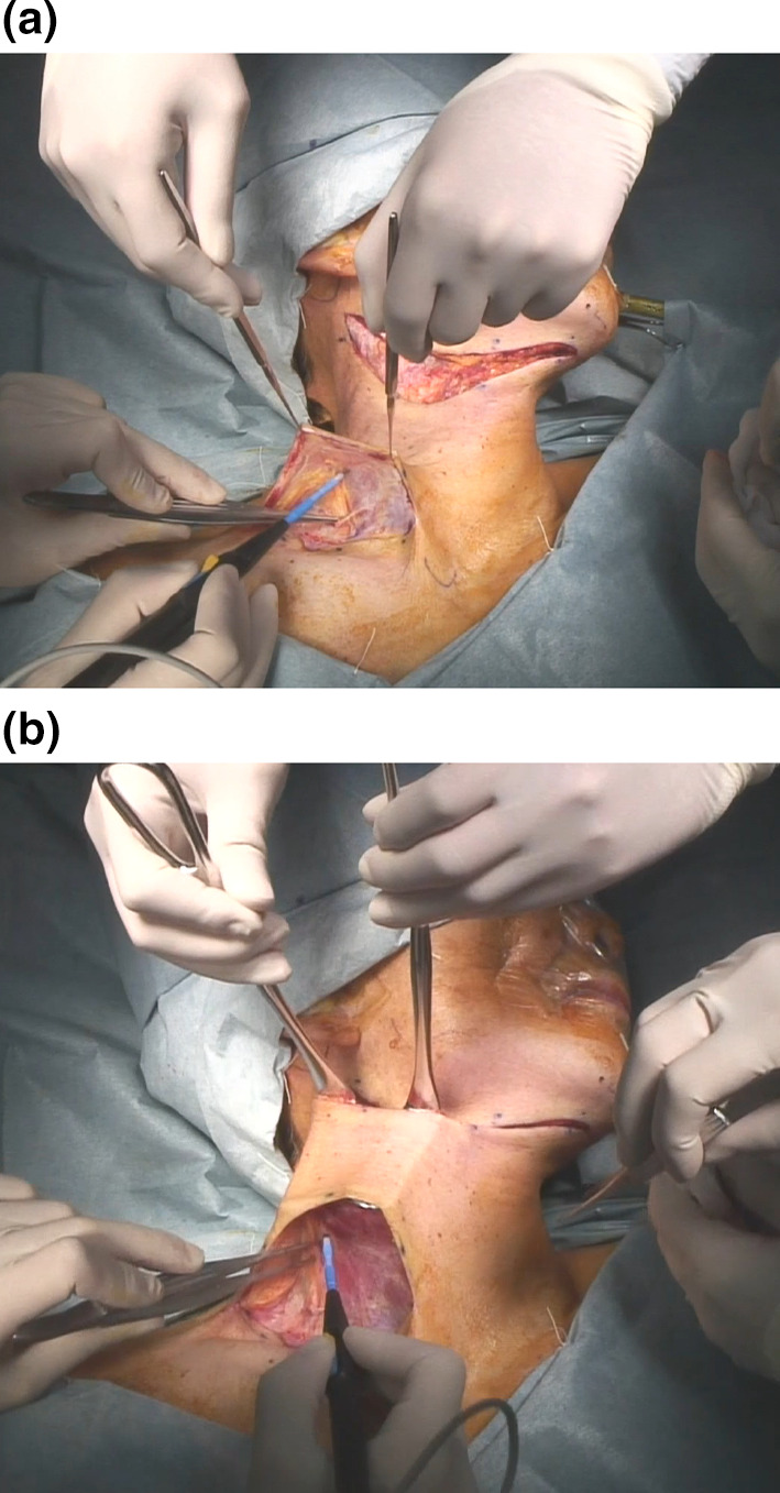 Fig. 3