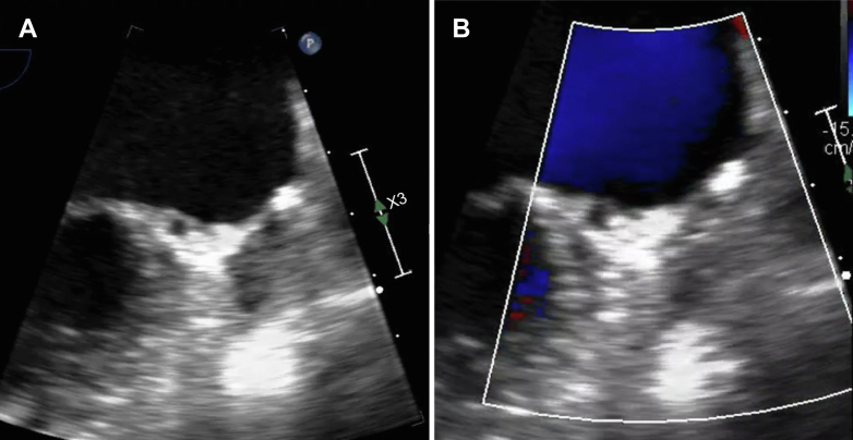 Figure 3