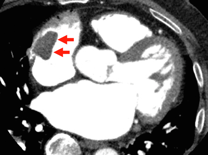 Figure 5