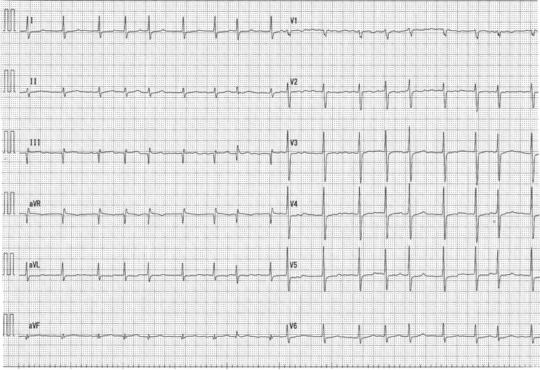 Figure 1