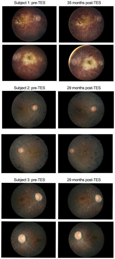 Fig. 4