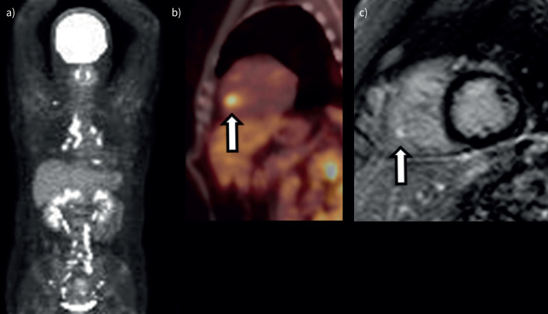 FIGURE 3