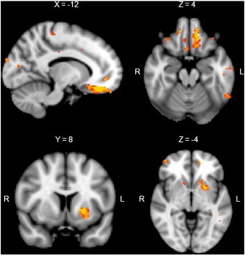 Fig. 3