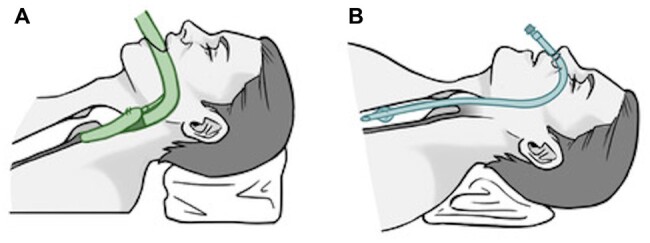 Figure 1: