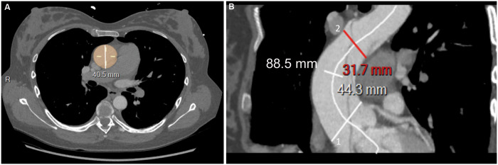 Figure 1: