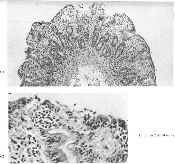 Fig 1C