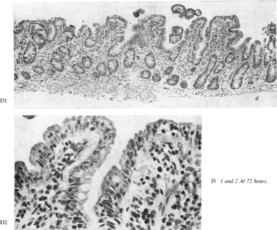 Fig 1D