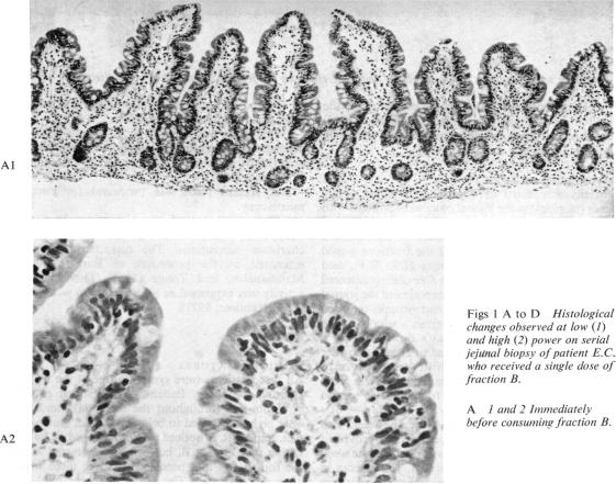 Fig 1A