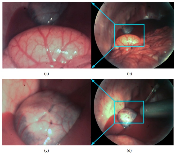 Fig. 11