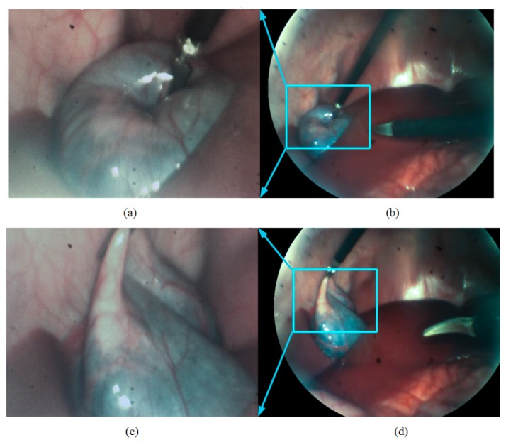 Fig. 12