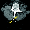 Fig 9.