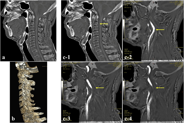 Figure 2.