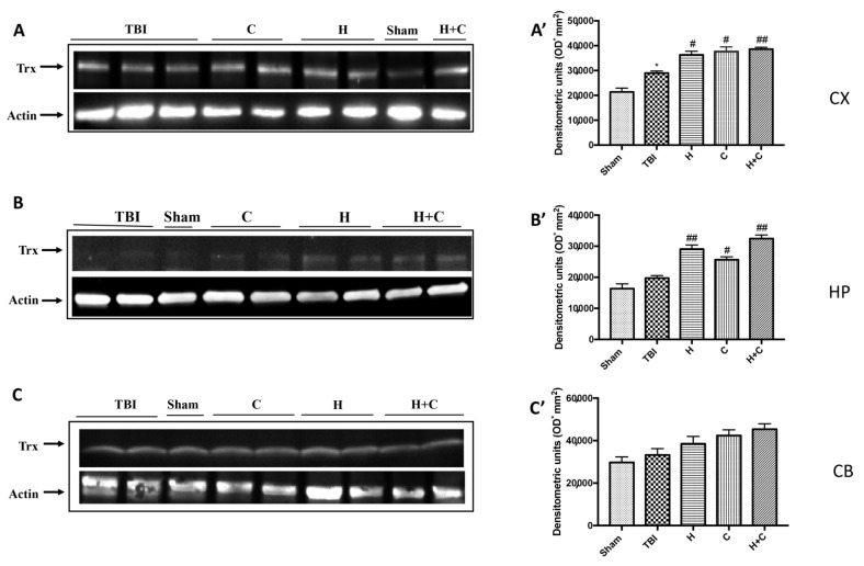 Figure 11