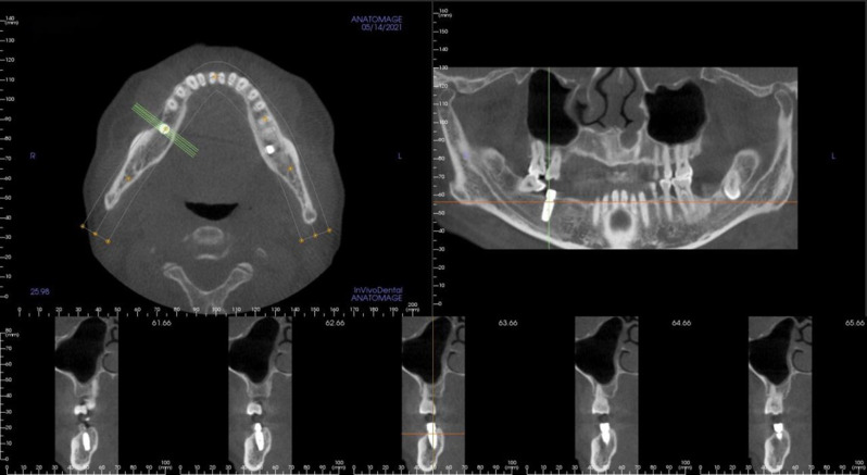 Fig. 3