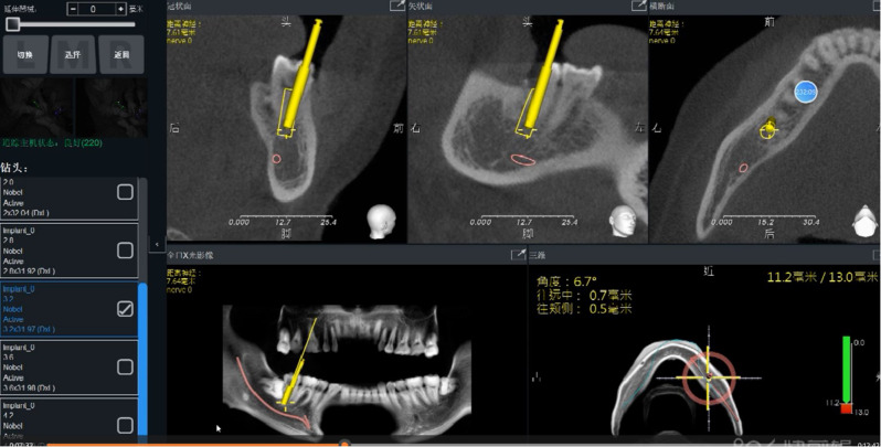 Fig. 2