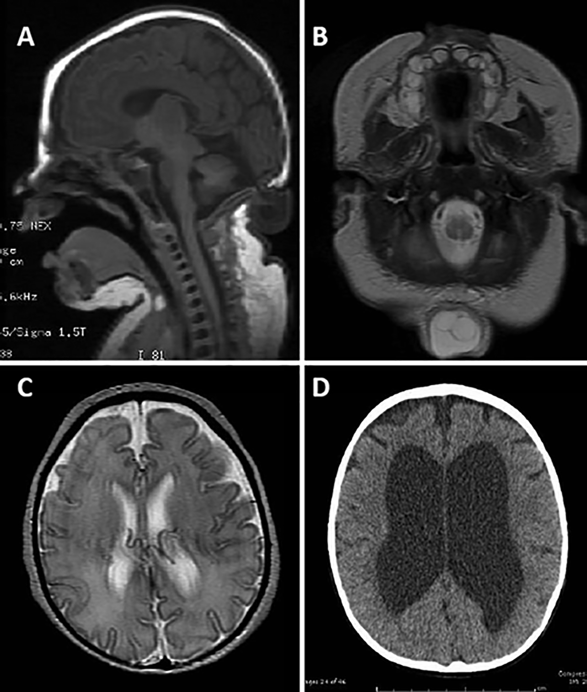 FIG. 2.