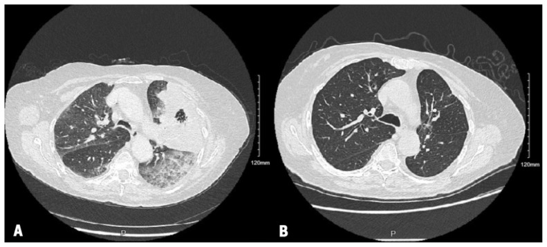 Figure 2: