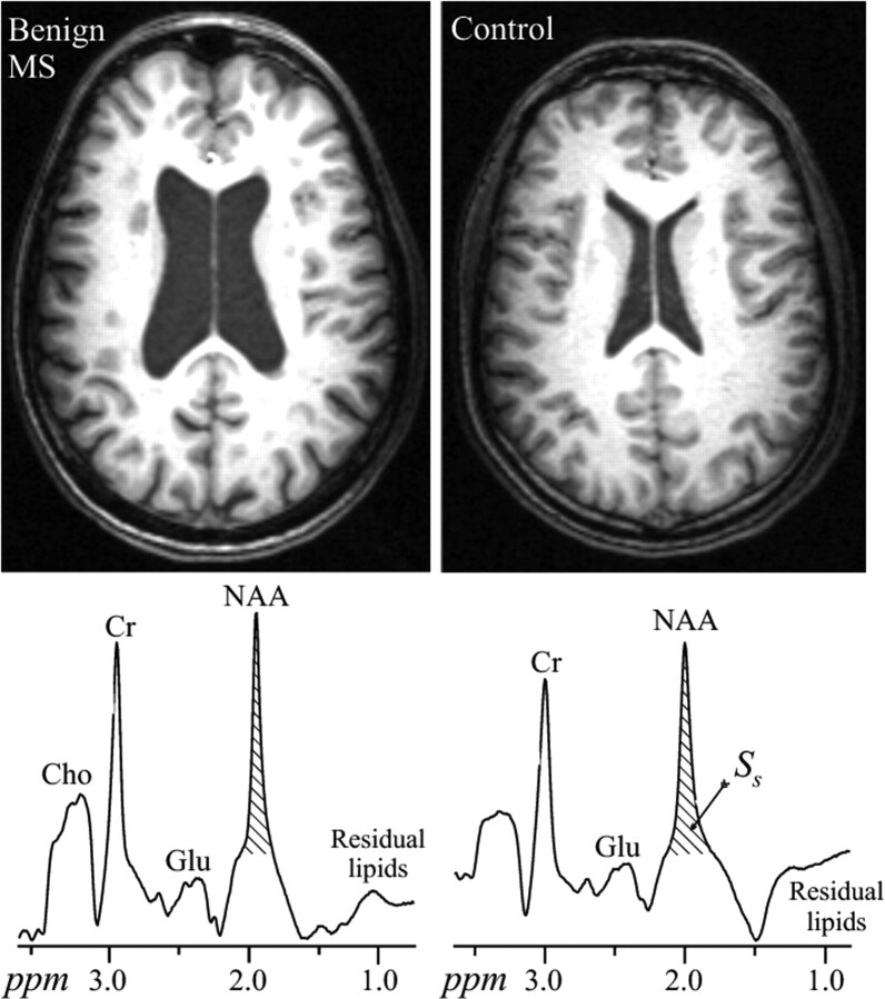 Fig 1.