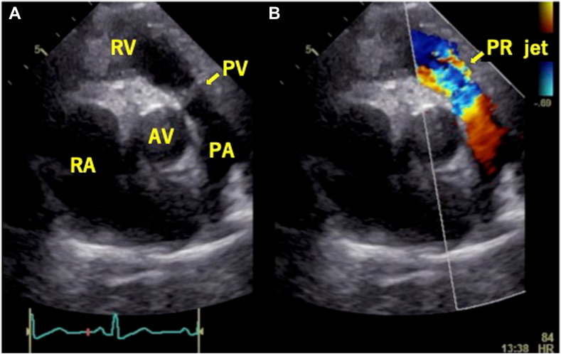 Figure 2