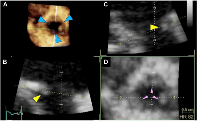 Figure 3