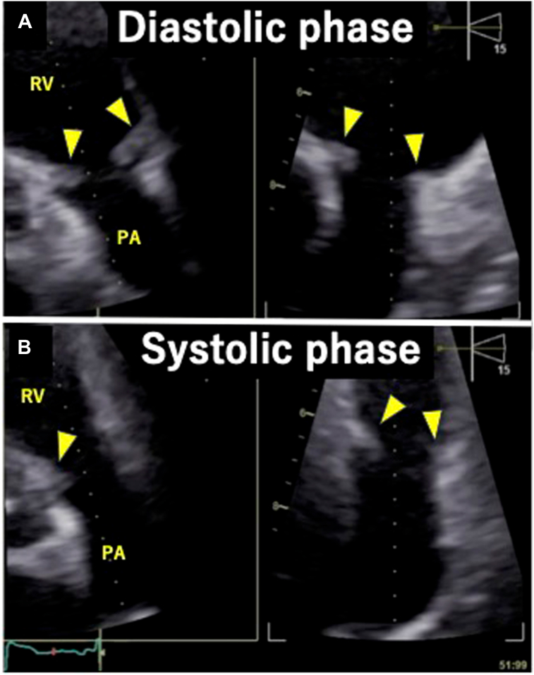 Figure 4