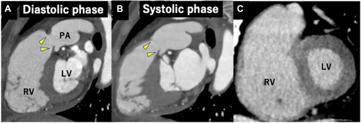 Figure 6