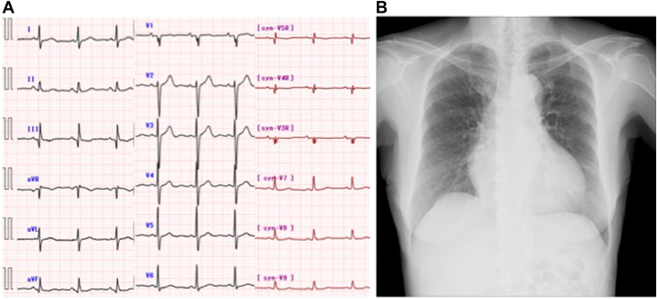 Figure 1