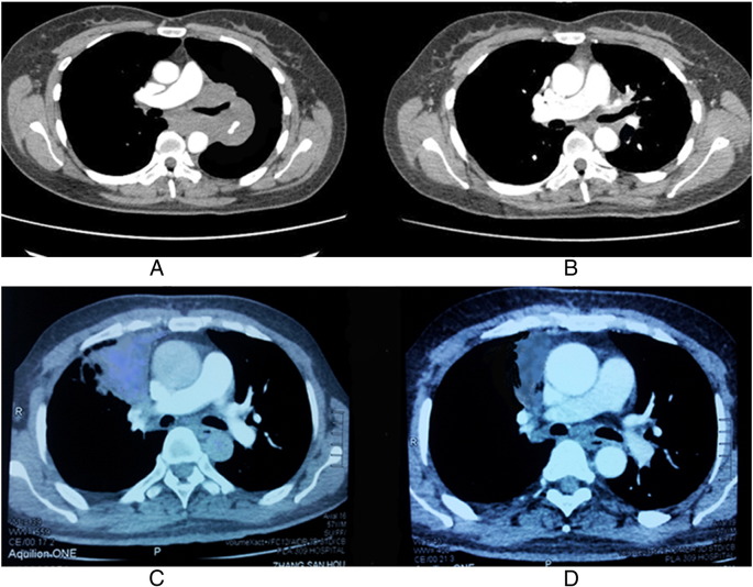 Figure 1