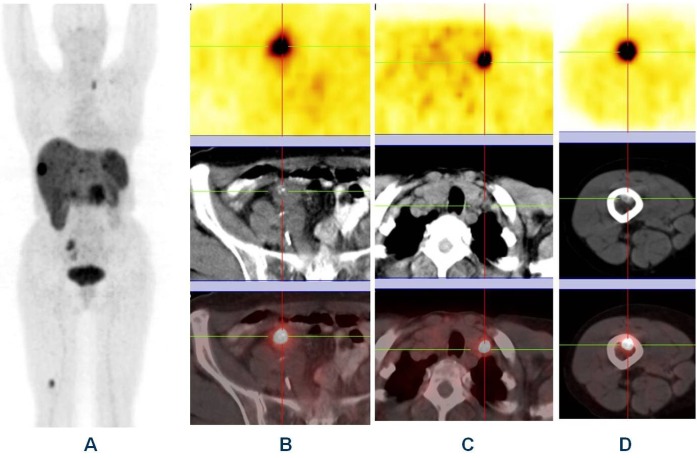 Fig 2