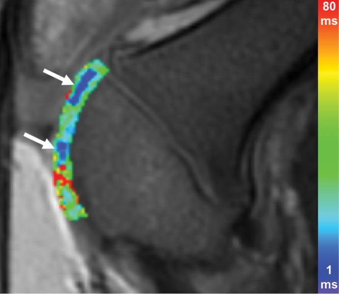 Figure 3b: