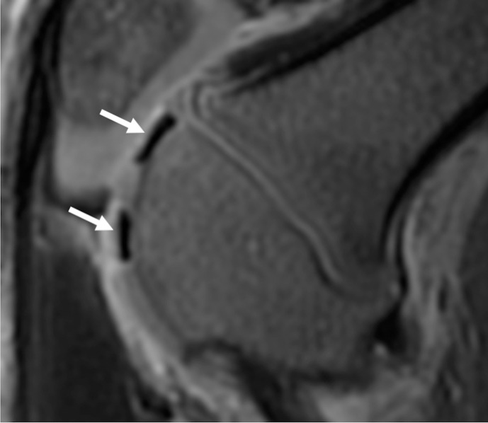 Figure 3a: