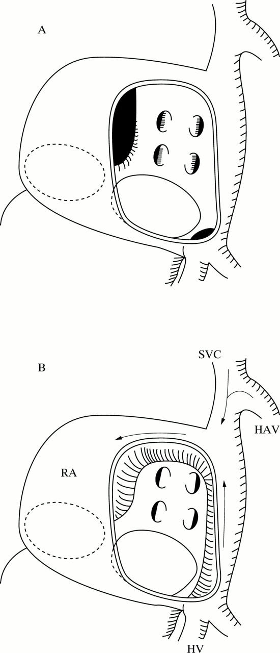 Figure 1  