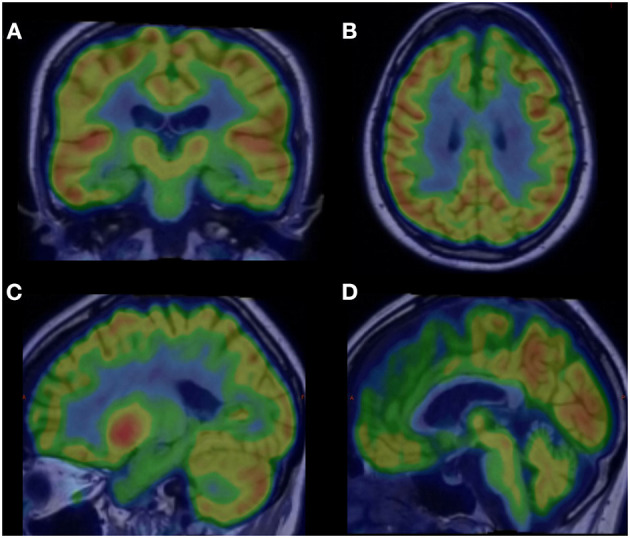 Figure 2