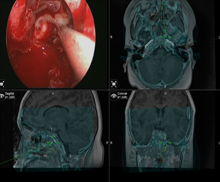 Fig. 4