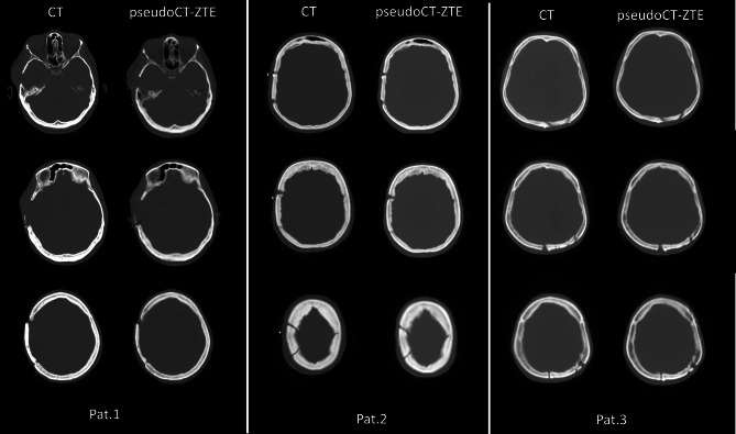 Fig. 9