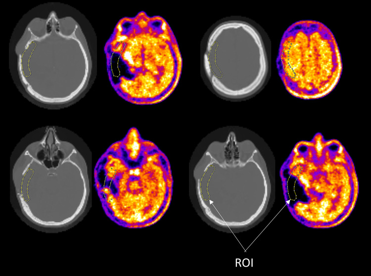 Fig. 5