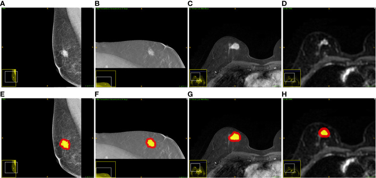 Figure 2