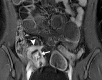 Figure 15a