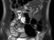 Figure 17b