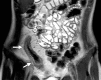 Figure 5c