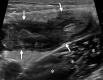 Figure 5b